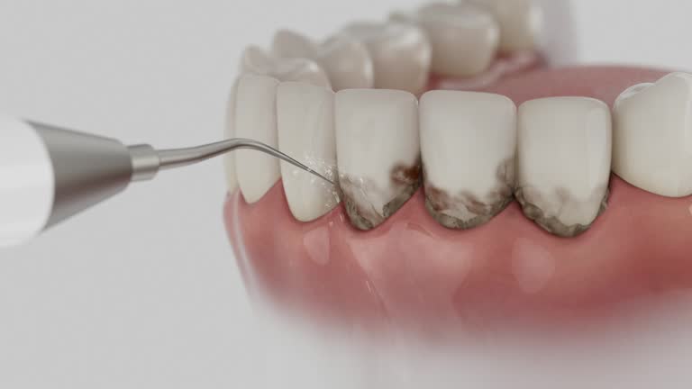 Trusted Teeth Cleaning And Checkup service in Windham, OH - Dentist Open Now